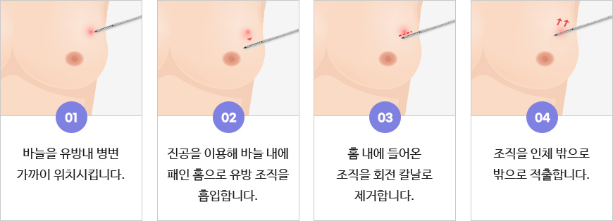 맘모톰이란?