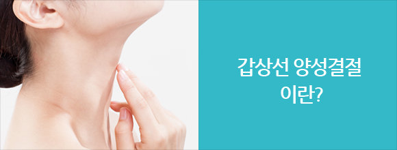 갑상선 양성 질환