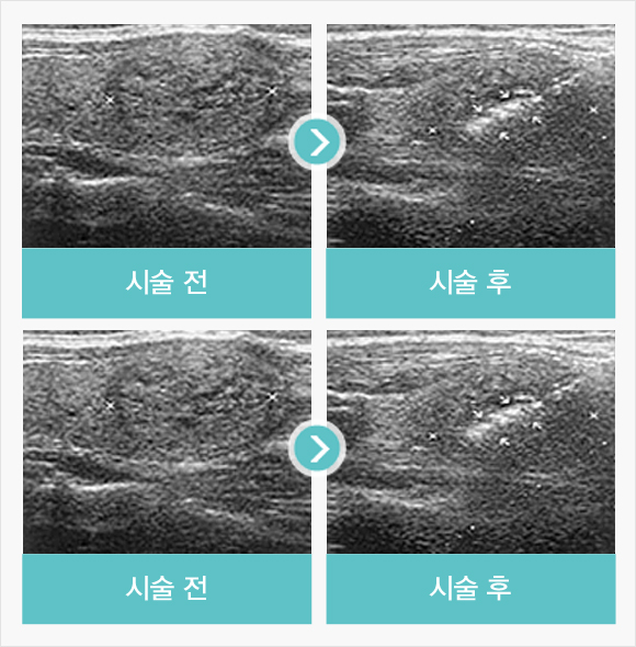 치료사례
